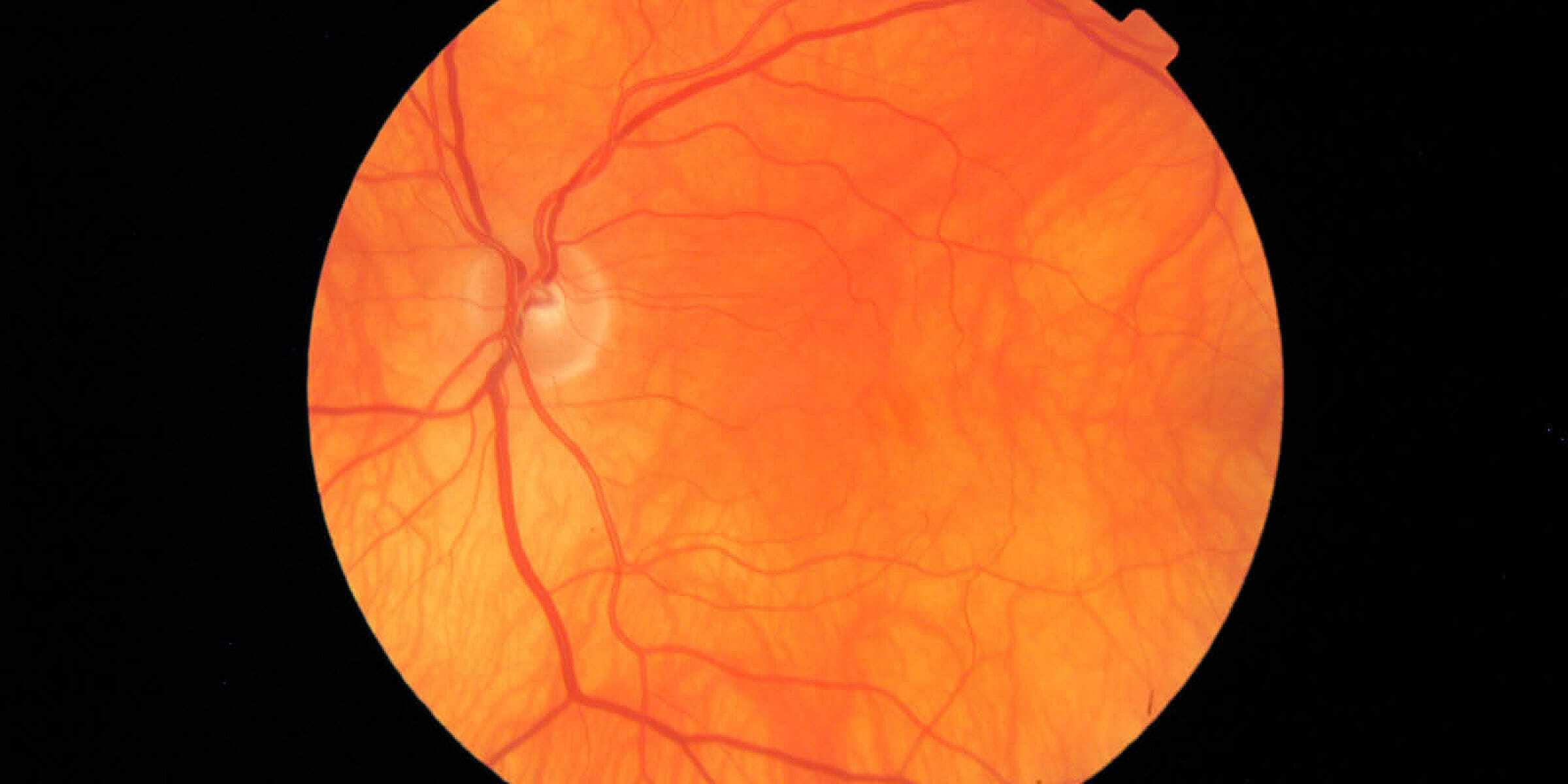 digital-retinal-imaging-w1200h600@2x